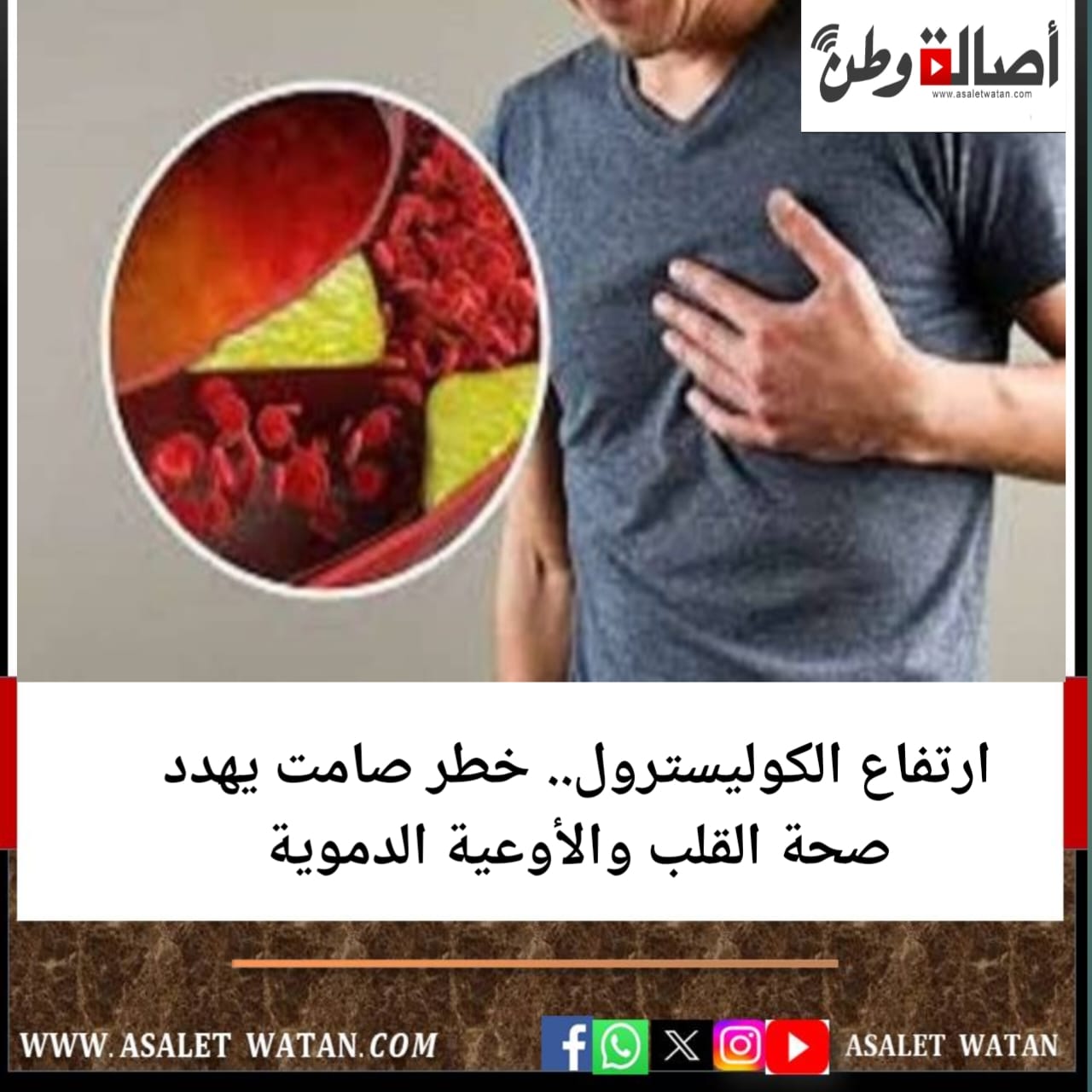 ارتفاع الكوليسترول.. خطر صامت يهدد صحة القلب والأوعية الدموية