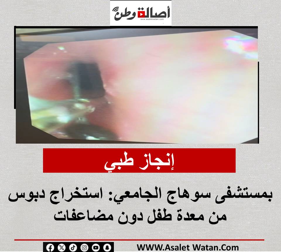 إنجاز طبي بمستشفى سوهاج الجامعي: استخراج دبوس من معدة طفل دون مضاعفات