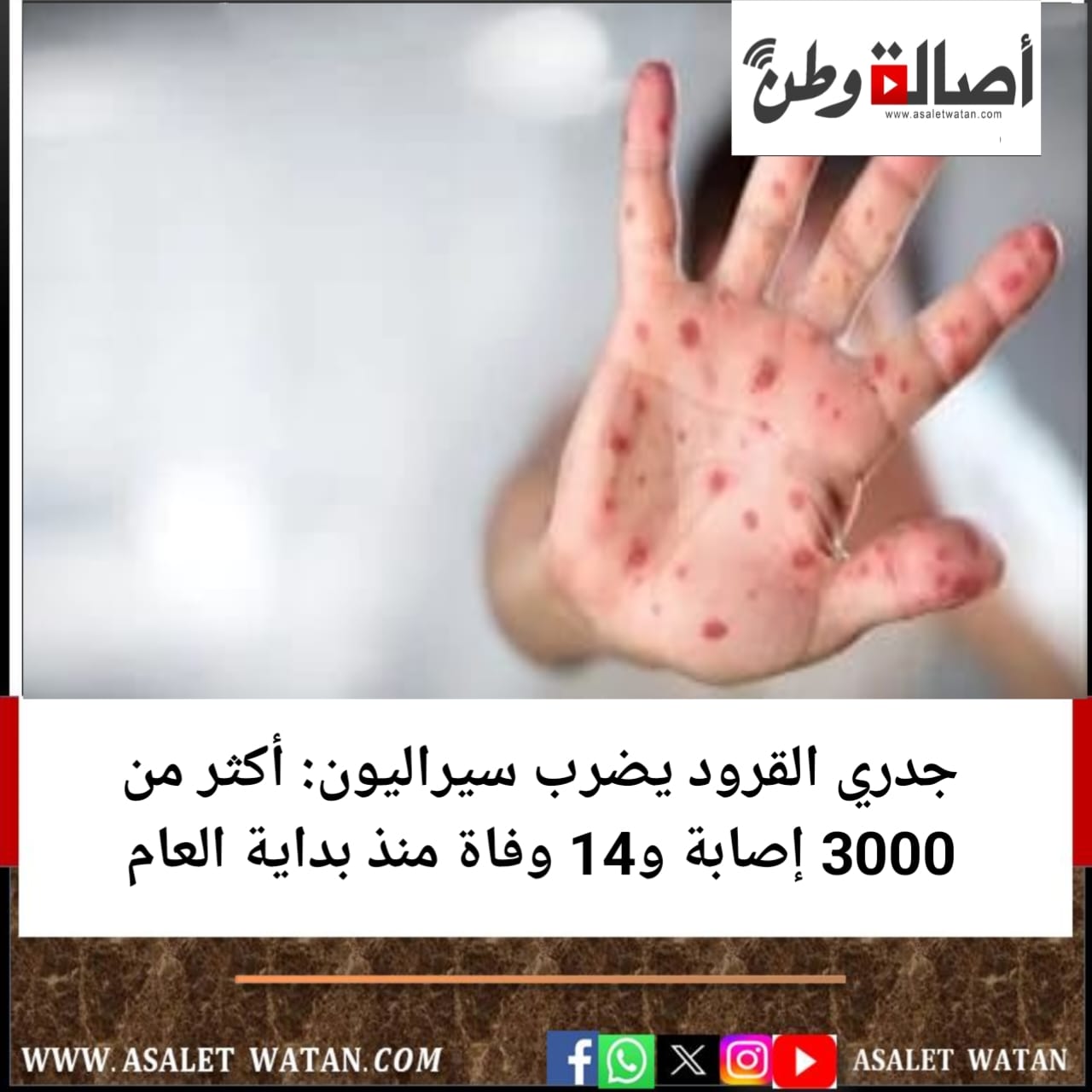 جدري القرود يضرب سيراليون: أكثر من 3000 إصابة و14 وفاة منذ بداية العام