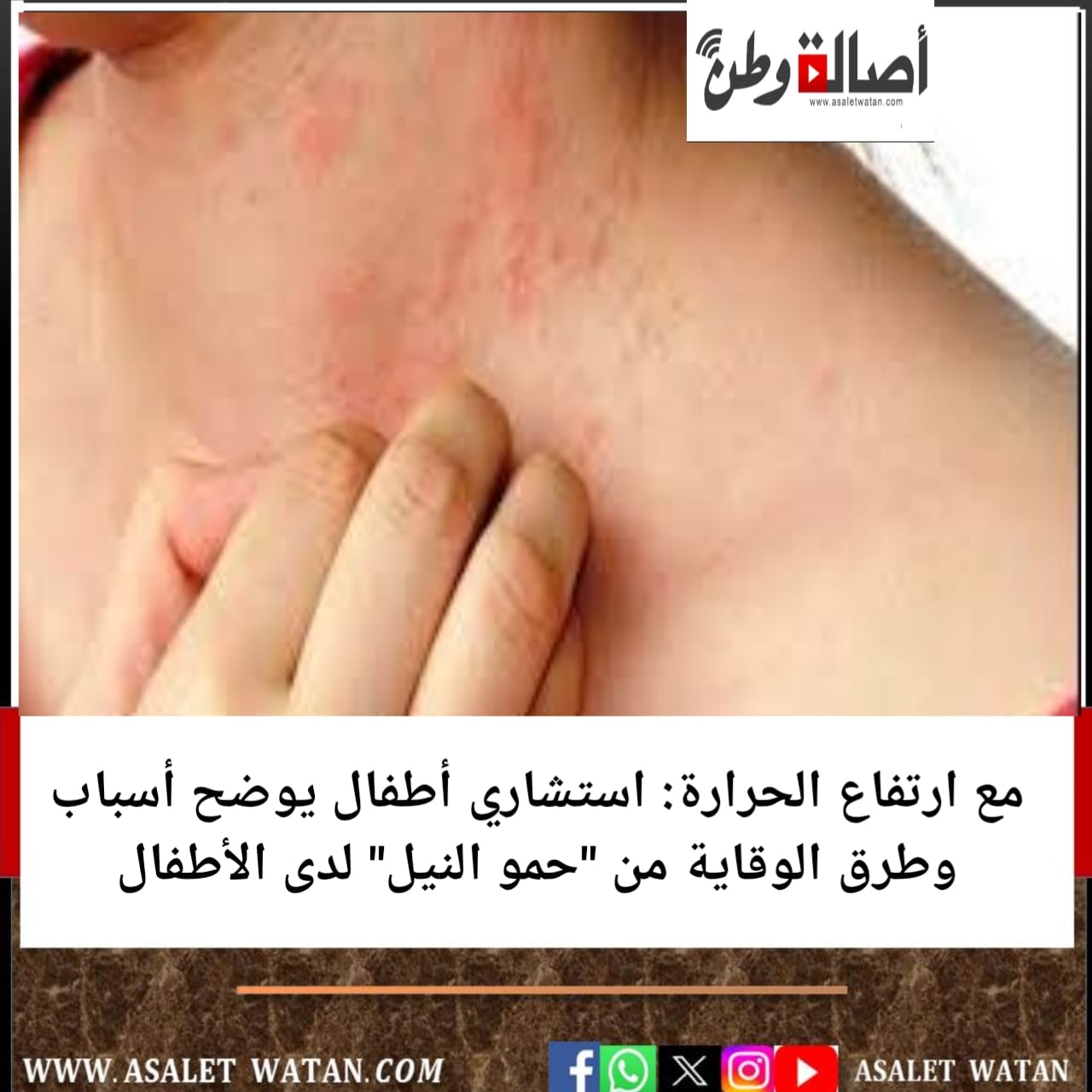 مع ارتفاع الحرارة: استشاري أطفال يوضح أسباب وطرق الوقاية من “حمو النيل” لدى الأطفال
