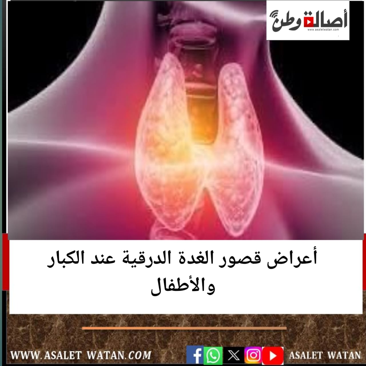 أعراض قصور الغدة الدرقية عند الكبار والأطفال