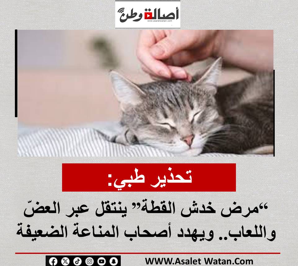 1تحذير طبي: “مرض خدش القطة” ينتقل عبر العضّ واللعاب.. ويهدد أصحاب المناعة الضعيفة