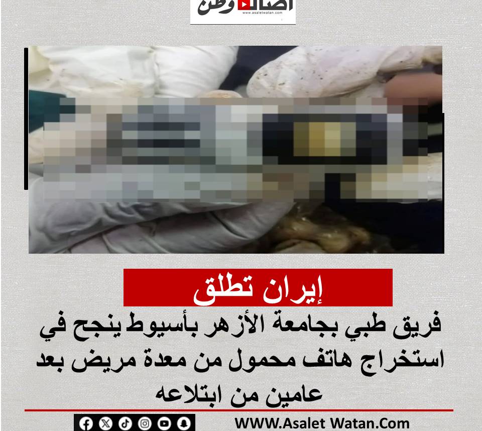 بلا جراحة: فريق طبي بجامعة الأزهر بأسيوط ينجح في استخراج هاتف محمول من معدة مريض بعد عامين من ابتلاعه