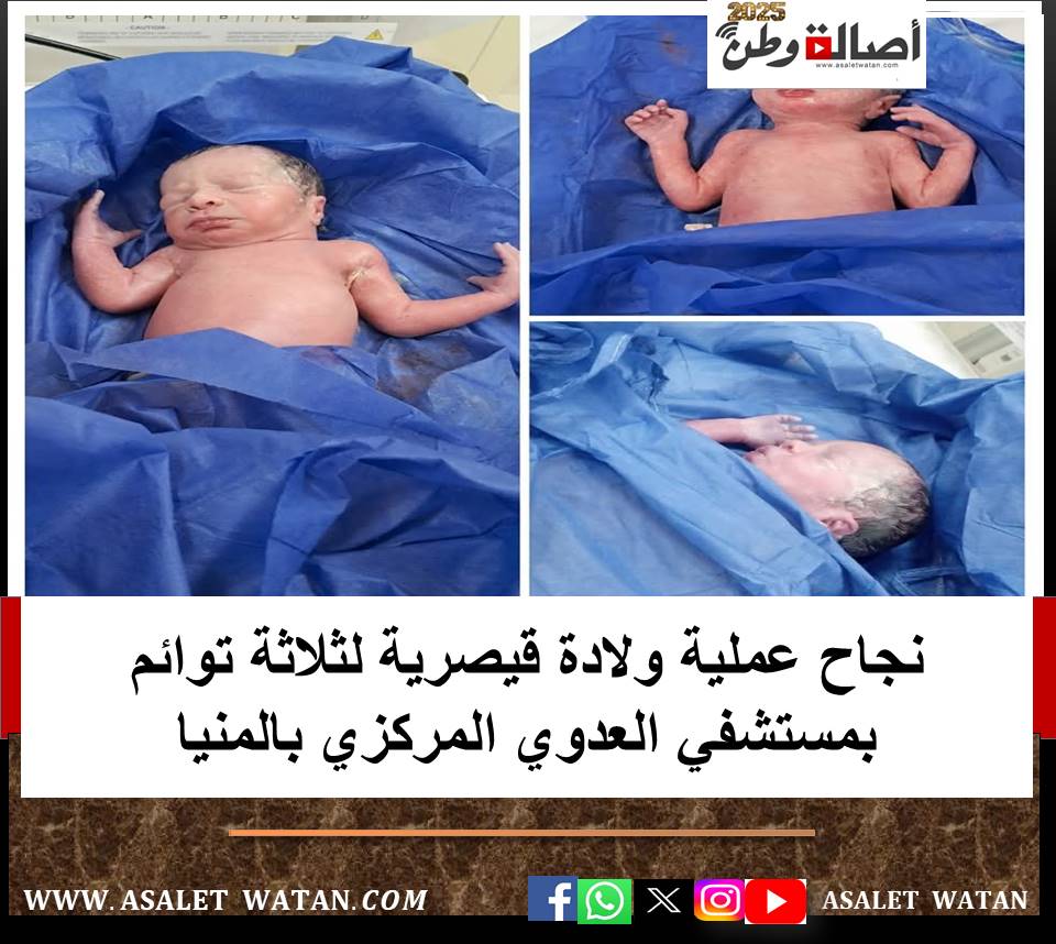نجاح عملية ولادة قيصرية لثلاثة توائم بمستشفي العدوي المركزي بالمنيا