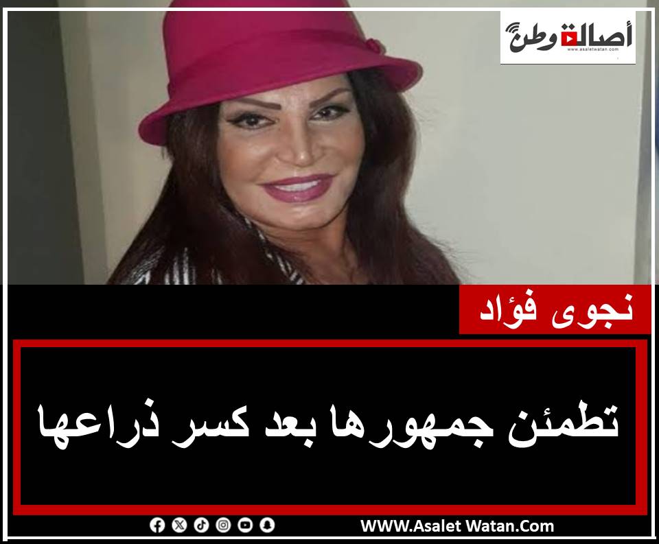 نجوى فؤاد تطمئن جمهورها بعد كسر ذراعها