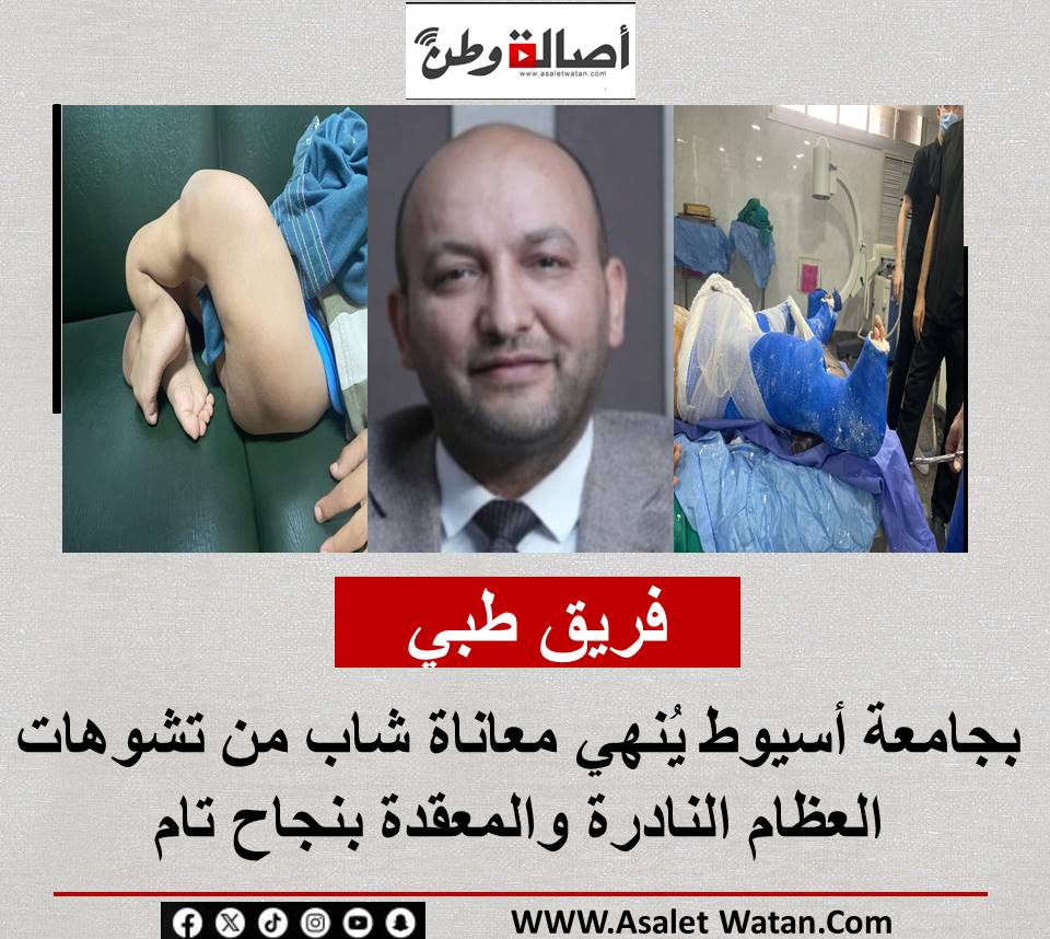 فريق طبي بجامعة أسيوط يُنهي معاناة شاب من تشوهات العظام النادرة والمعقدة بنجاح تام